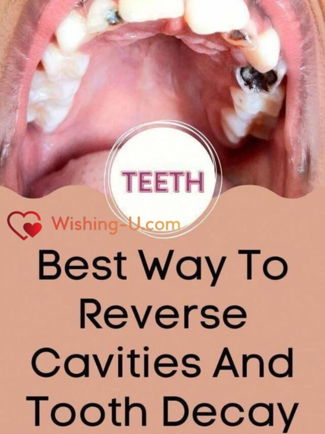 दांतों को सड़न और कैविटीज से बचाने के लिए ध्यान रखें ये 6 टिप्स